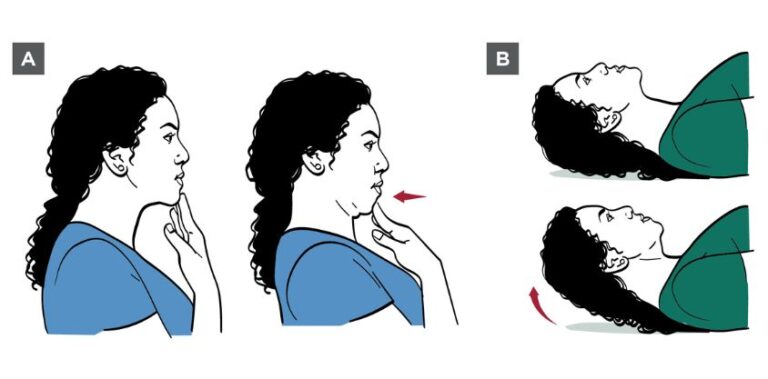 How To Fix Forward Head Posture: 3 Stretching Exercises to Try