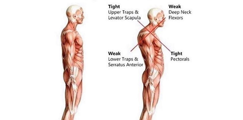 Combat Rounded Shoulders and Sit Straighter With These Simple Stretches